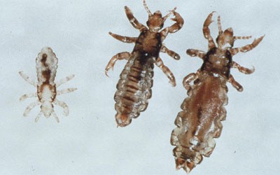 Five Tips to Protect Your Kids from Head Lice