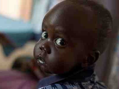 South Sudan: Lack of Funds Puts Lives of Children at Risk